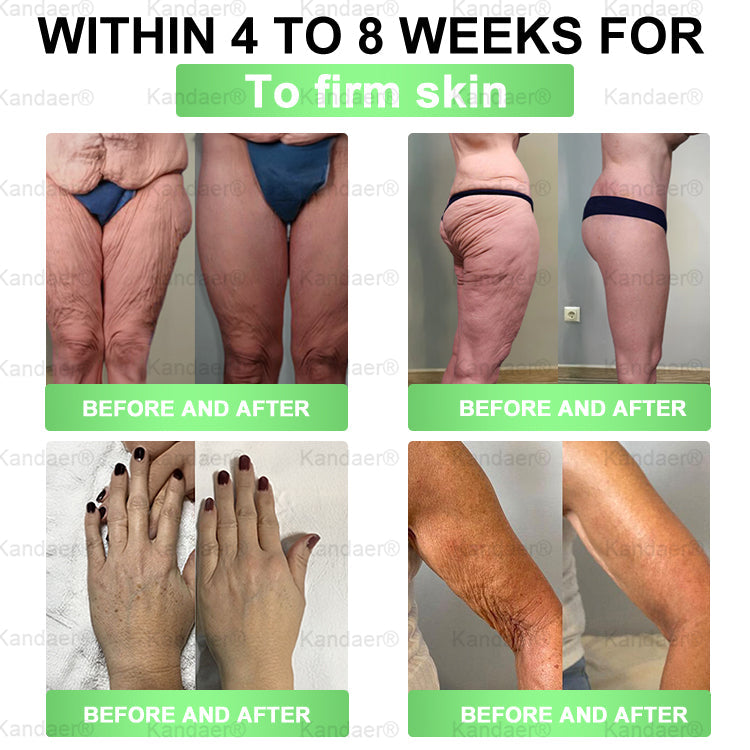 𝐊𝗮𝗻𝐝𝒂𝒆𝒓®𝑮𝗟𝑃-1 8-𝐁𝒆𝒏𝒆𝗳𝗶𝘁  𝑺𝗹𝗶𝗺 & 𝙈𝐞𝐭𝐚𝒃𝗼𝗹𝗶𝗰 𝗢𝒓𝒂𝒍 𝑺𝒐𝒍𝐮𝐭𝐢𝐨𝐧 (𝗢𝒏𝒄𝒆 𝒂 𝑫𝒂𝐲，𝒗𝐢𝐬𝐢𝐛𝐥𝐞 𝙧𝗲𝘀𝘂𝗹𝘁𝘀 𝙞𝒏 7 𝑫𝗮𝘆𝒔 ) 𝑭𝐨𝐫 𝒘𝗲𝗶𝗴𝗵𝘁 𝒄𝗼𝗻𝘁𝗿𝗼𝗹 / 𝒉𝐞𝐚𝐫𝐭 𝒉𝐞𝐚𝐥𝐭𝐡 / 𝒃𝐥𝐨𝐨𝐝 𝒔𝐮𝐠𝐚𝐫 / 𝒔𝐥𝐞𝐞𝐩 𝒒𝐮𝐚𝐥𝐢𝐭𝐲 / 𝒅𝐢𝐠𝐞𝐬𝐭𝐢𝐨𝐧 / 𝒘𝐨𝐦𝐞𝐧'𝐬 𝒄𝐨𝐦𝐟𝐨𝐫𝐭 / 𝒋𝐨𝐢𝐧𝐭 𝒎𝐨𝐛𝐢𝐥𝐢𝐭𝐲